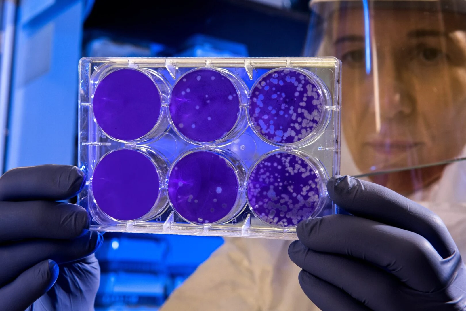A scientist in protective gear examining a six-well plate with purple bacterial colonies