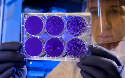 Coronavirus, Flu and Colds: Natural Immune Support Strategies