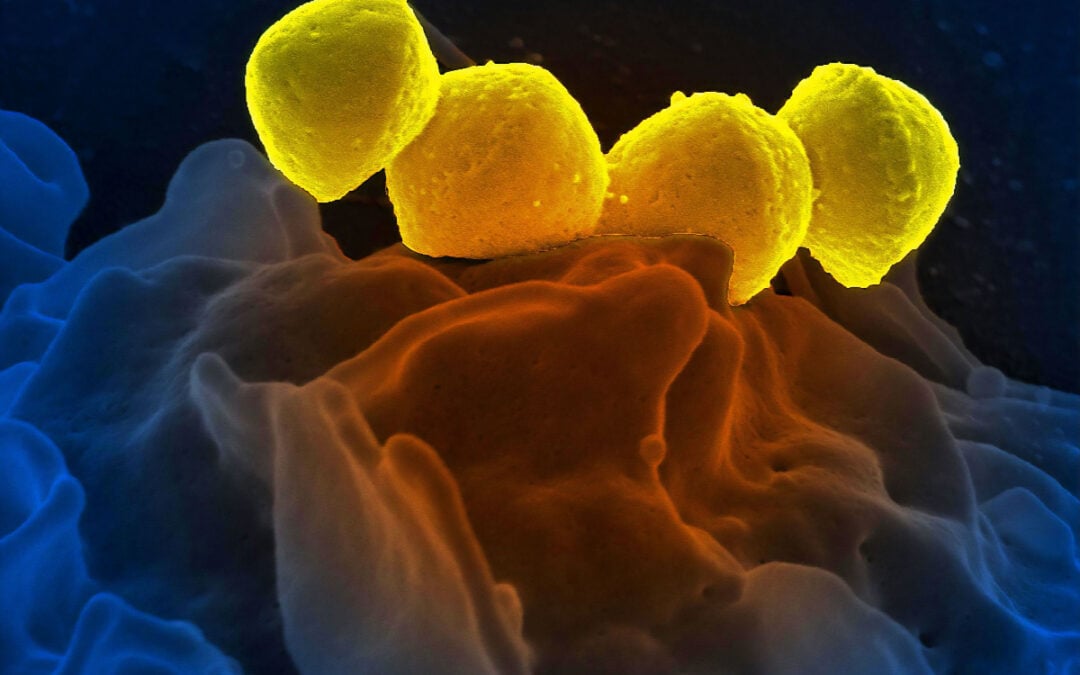 Good Gut Health: Yeastie Beasties and Treatsies